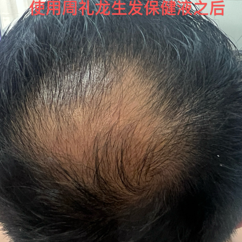 详情图片
