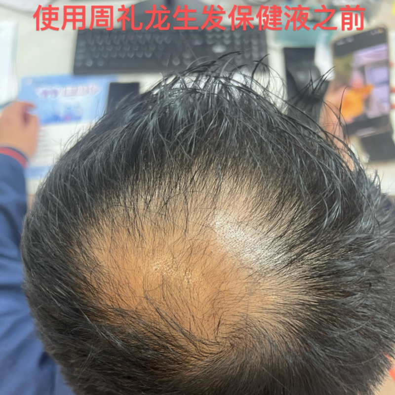 详情图片